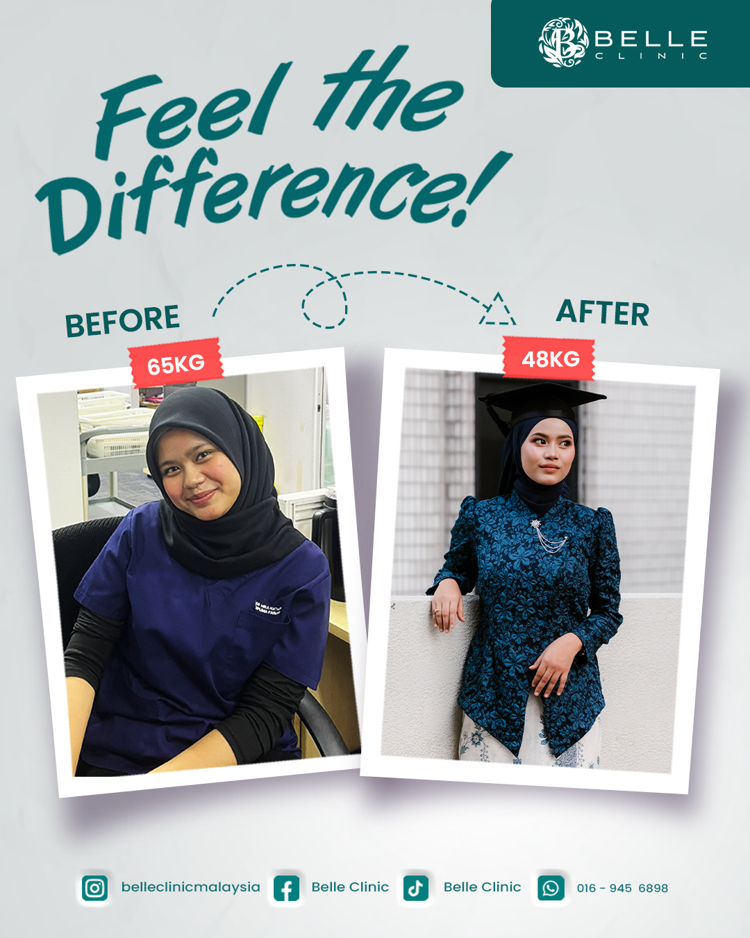 Sebelum dan selepas: 65kg ke 48kg, pelanggan Belle Clinic